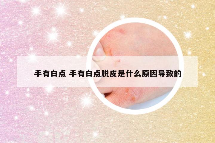 手有白点 手有白点脱皮是什么原因导致的