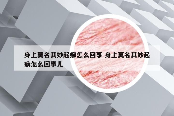 身上莫名其妙起癣怎么回事 身上莫名其妙起癣怎么回事儿