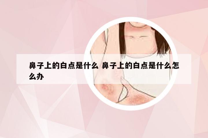 鼻子上的白点是什么 鼻子上的白点是什么怎么办