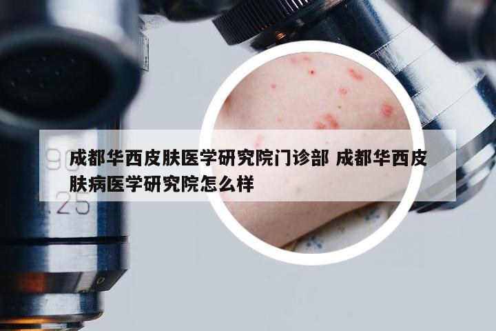 成都华西皮肤医学研究院门诊部 成都华西皮肤病医学研究院怎么样