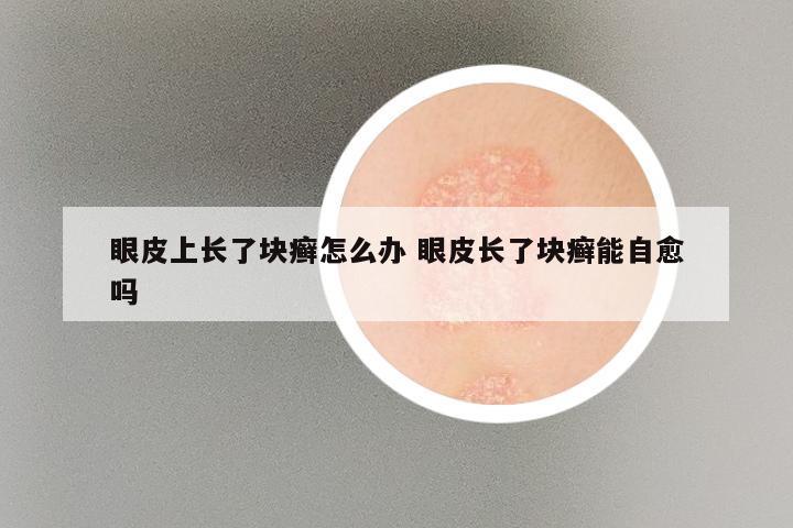 眼皮上长了块癣怎么办 眼皮长了块癣能自愈吗