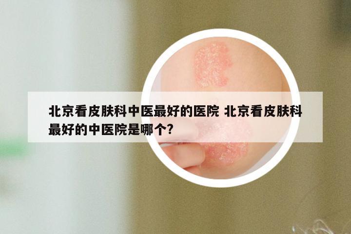 北京看皮肤科中医最好的医院 北京看皮肤科最好的中医院是哪个?