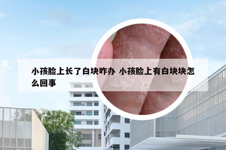 小孩脸上长了白块咋办 小孩脸上有白块块怎么回事