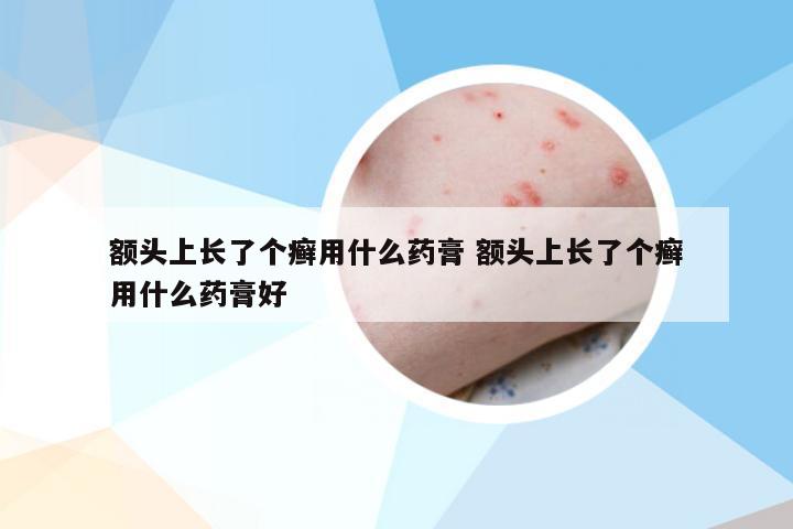 额头上长了个癣用什么药膏 额头上长了个癣用什么药膏好