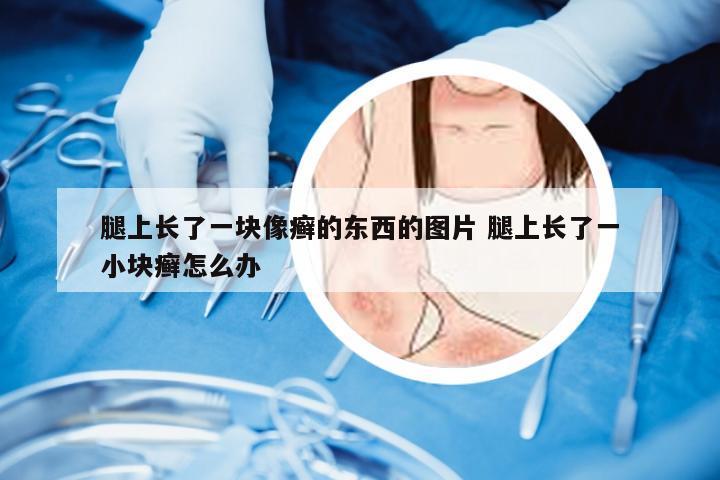 腿上长了一块像癣的东西的图片 腿上长了一小块癣怎么办