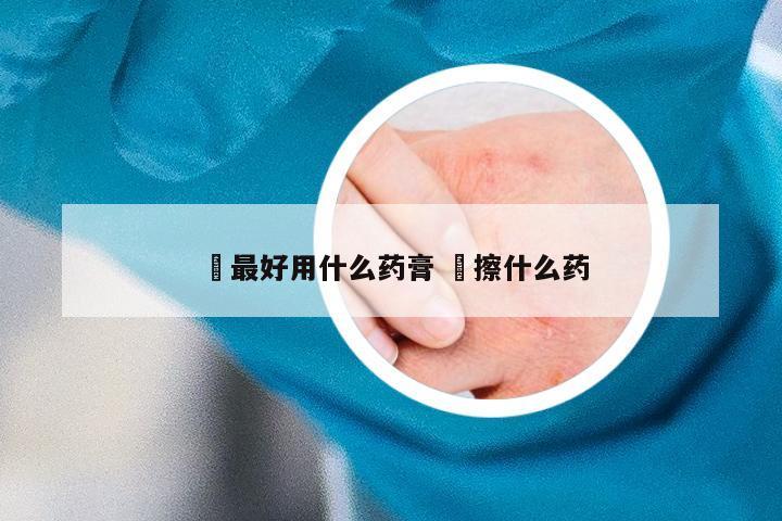 廯最好用什么药膏 廯擦什么药