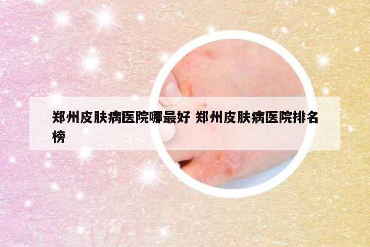 郑州皮肤病医院哪最好 郑州皮肤病医院排名榜