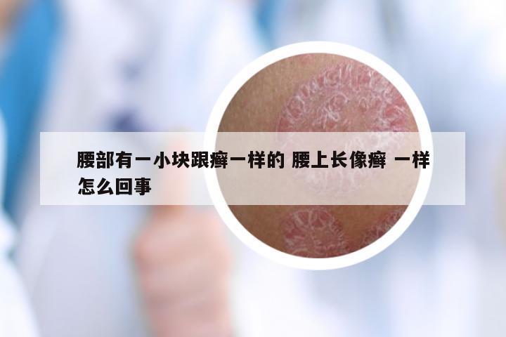 腰部有一小块跟癣一样的 腰上长像癣 一样怎么回事