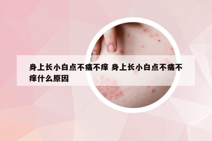 身上长小白点不痛不痒 身上长小白点不痛不痒什么原因