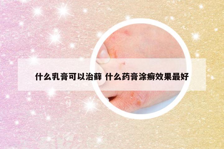 什么乳膏可以治藓 什么药膏涂癣效果最好