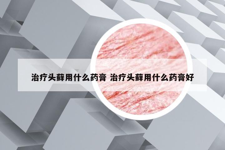 治疗头藓用什么药膏 治疗头藓用什么药膏好