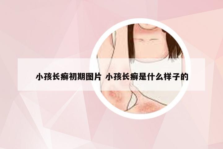 小孩长癣初期图片 小孩长癣是什么样子的