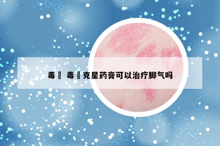 毒廯 毒廯克星药膏可以治疗脚气吗