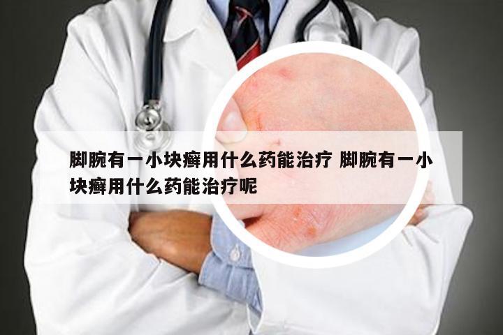 脚腕有一小块癣用什么药能治疗 脚腕有一小块癣用什么药能治疗呢