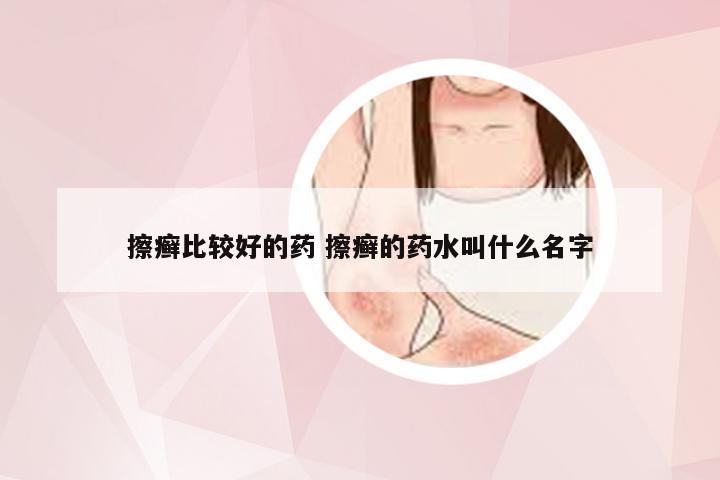 擦癣比较好的药 擦癣的药水叫什么名字