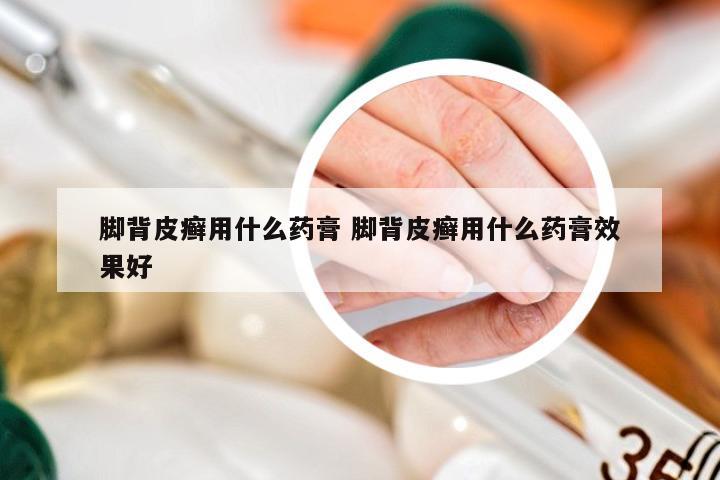 脚背皮癣用什么药膏 脚背皮癣用什么药膏效果好