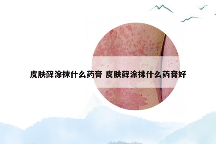 皮肤藓涂抹什么药膏 皮肤藓涂抹什么药膏好