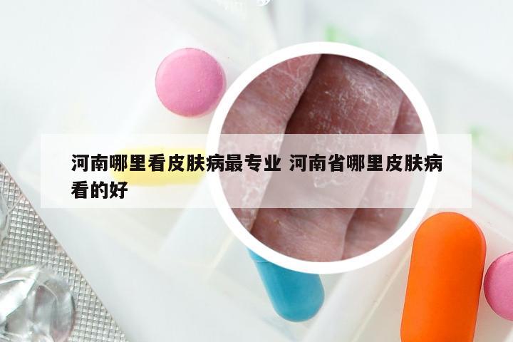 河南哪里看皮肤病最专业 河南省哪里皮肤病看的好