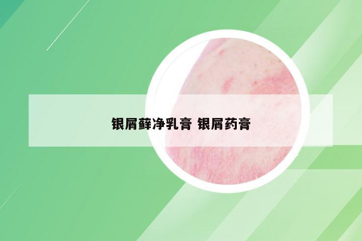 银屑藓净乳膏 银屑药膏