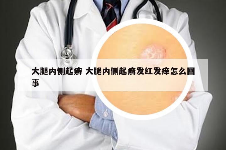 大腿内侧起癣 大腿内侧起癣发红发痒怎么回事