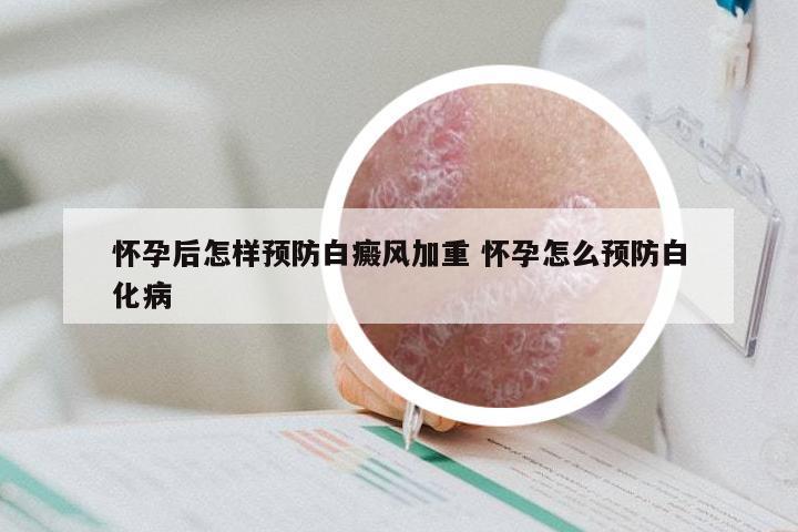 怀孕后怎样预防白癜风加重 怀孕怎么预防白化病