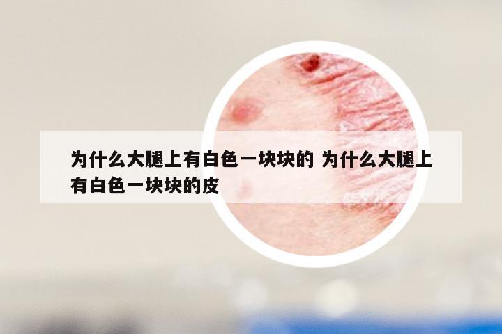 为什么大腿上有白色一块块的 为什么大腿上有白色一块块的皮