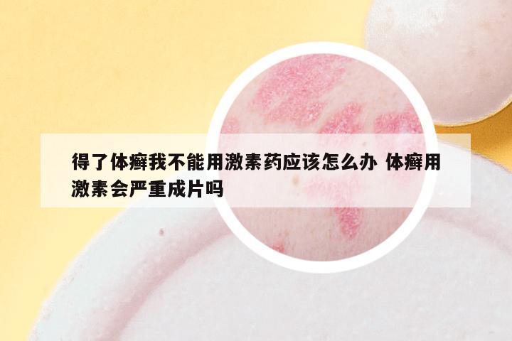 得了体癣我不能用激素药应该怎么办 体癣用激素会严重成片吗