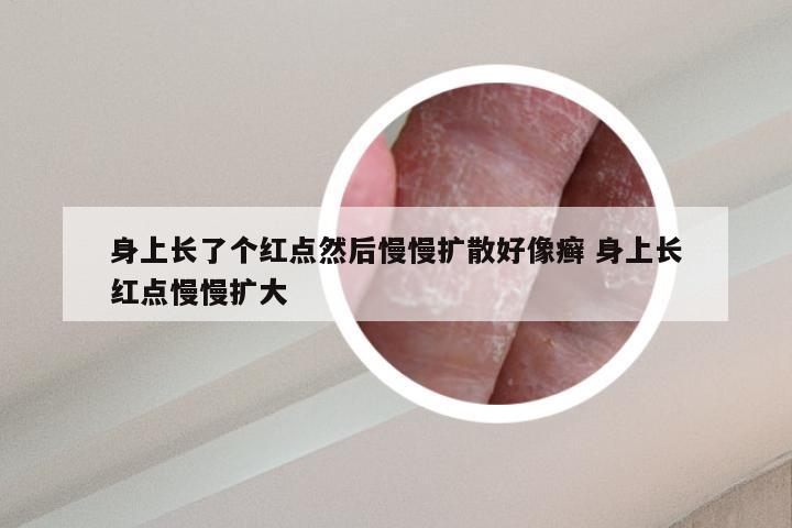 身上长了个红点然后慢慢扩散好像癣 身上长红点慢慢扩大