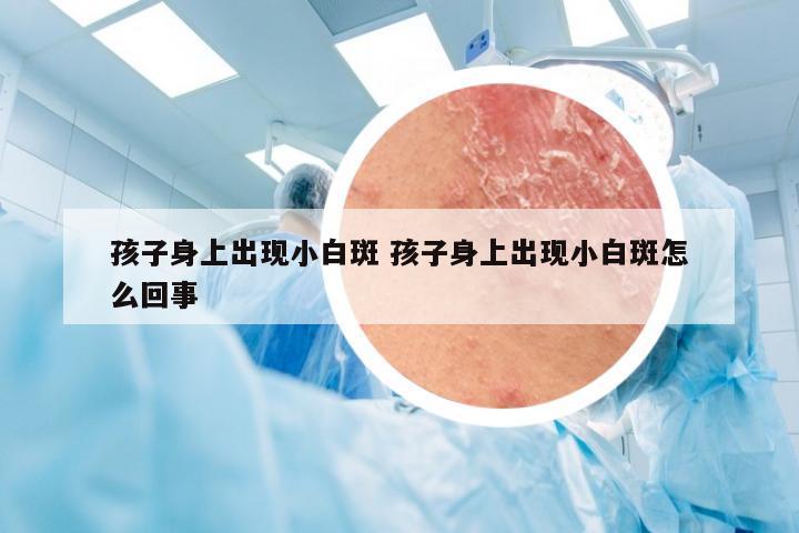 孩子身上出现小白斑 孩子身上出现小白斑怎么回事