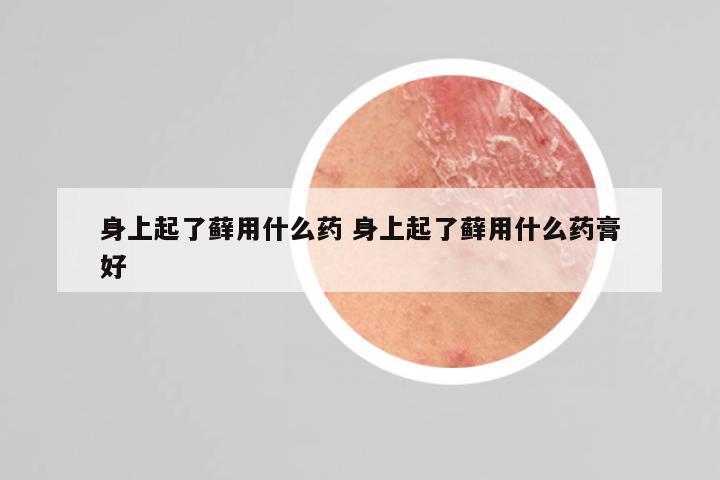 身上起了藓用什么药 身上起了藓用什么药膏好