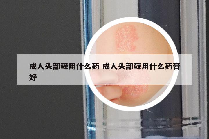 成人头部藓用什么药 成人头部藓用什么药膏好