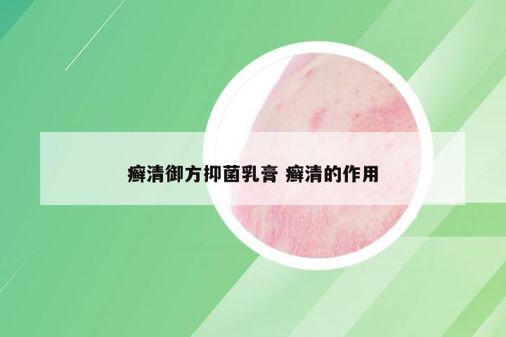 癣清御方抑菌乳膏 癣清的作用