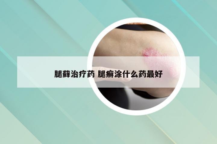 腿藓治疗药 腿癣涂什么药最好