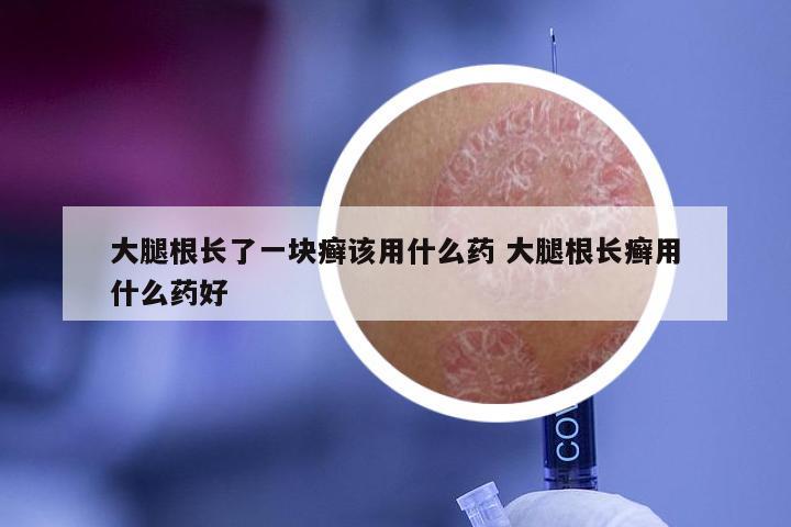 大腿根长了一块癣该用什么药 大腿根长癣用什么药好