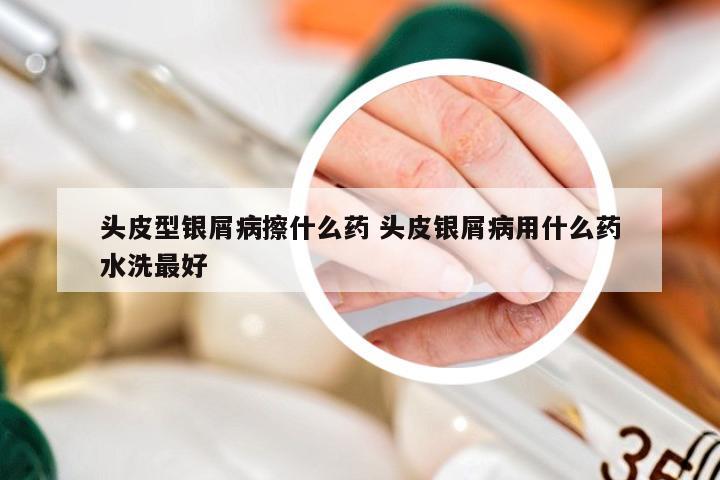 头皮型银屑病擦什么药 头皮银屑病用什么药水洗最好