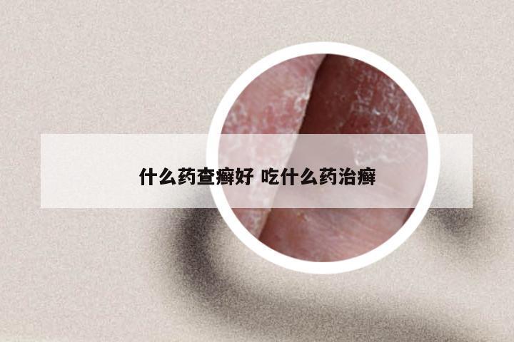 什么药查癣好 吃什么药治癣