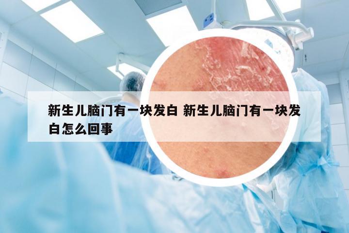 新生儿脑门有一块发白 新生儿脑门有一块发白怎么回事