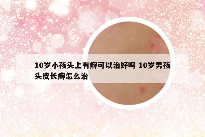 10岁小孩头上有癣可以治好吗 10岁男孩头皮长癣怎么治