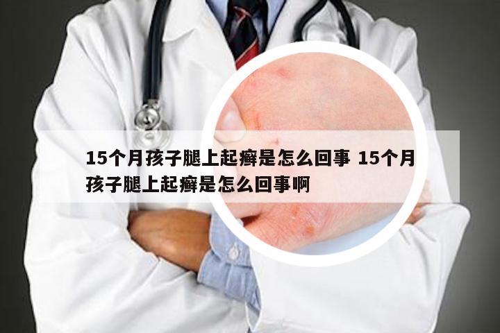 15个月孩子腿上起癣是怎么回事 15个月孩子腿上起癣是怎么回事啊