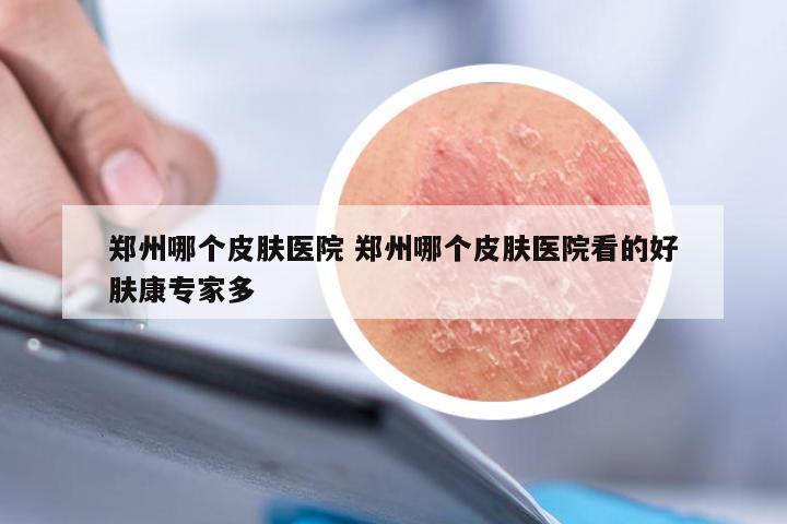 郑州哪个皮肤医院 郑州哪个皮肤医院看的好肤康专家多