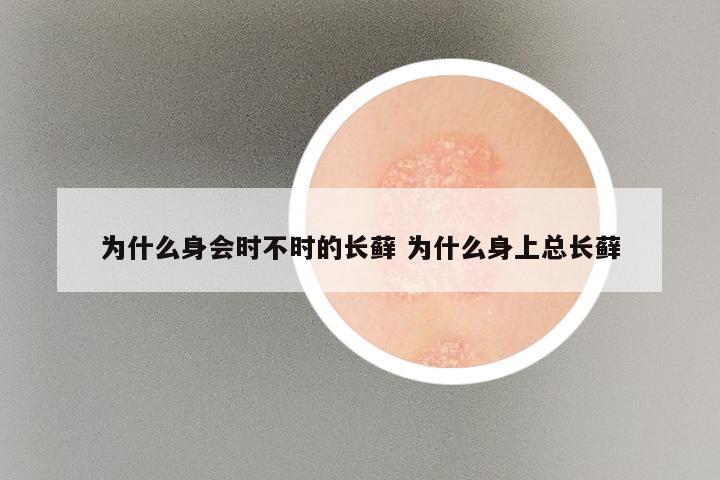 为什么身会时不时的长藓 为什么身上总长藓