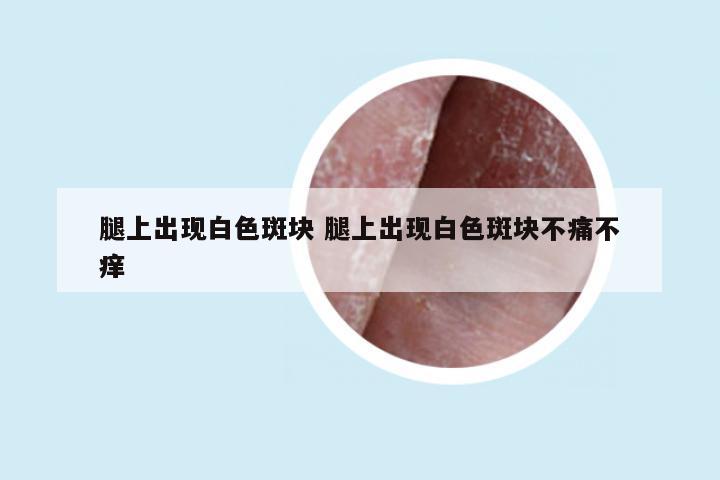 腿上出现白色斑块 腿上出现白色斑块不痛不痒