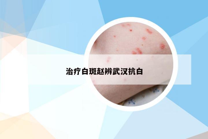 治疗白斑赵辨武汉抗白