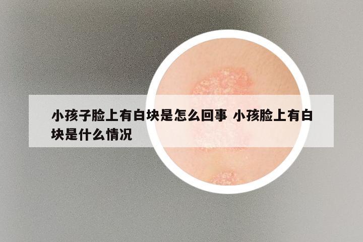 小孩子脸上有白块是怎么回事 小孩脸上有白块是什么情况