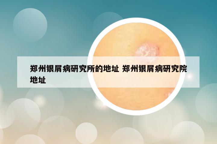 郑州银屑病研究所的地址 郑州银屑病研究院地址