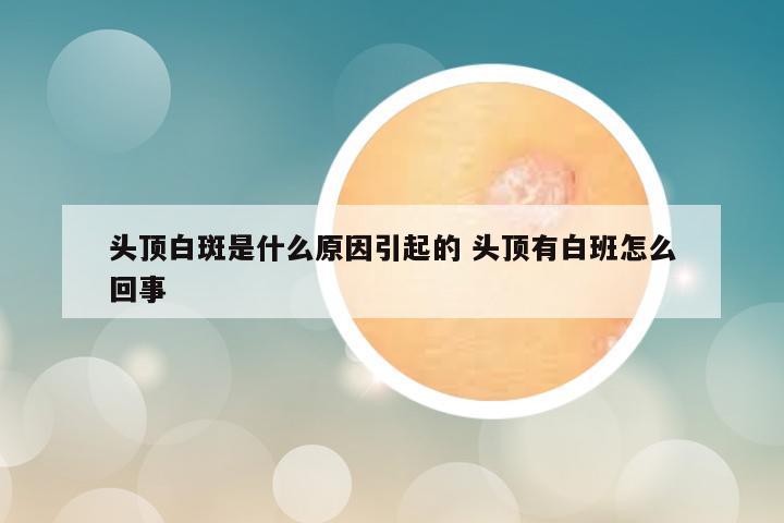 头顶白斑是什么原因引起的 头顶有白班怎么回事