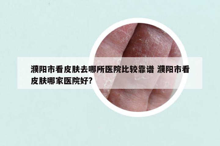 濮阳市看皮肤去哪所医院比较靠谱 濮阳市看皮肤哪家医院好?