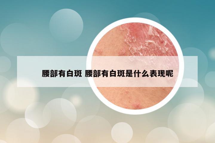 腰部有白斑 腰部有白斑是什么表现呢