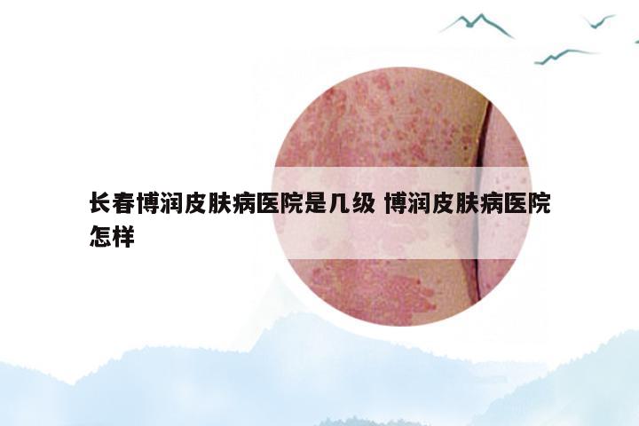 长春博润皮肤病医院是几级 博润皮肤病医院怎样