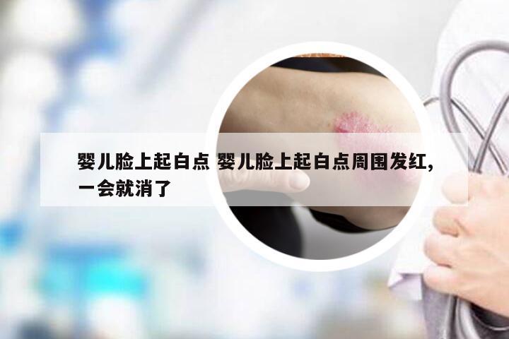 婴儿脸上起白点 婴儿脸上起白点周围发红,一会就消了